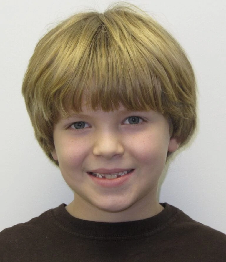 Smiling child with blonde hair showing dental progress, highlighting orthodontic treatment results for pediatric dentistry.